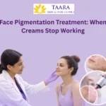 Face Pigmentation Treatment