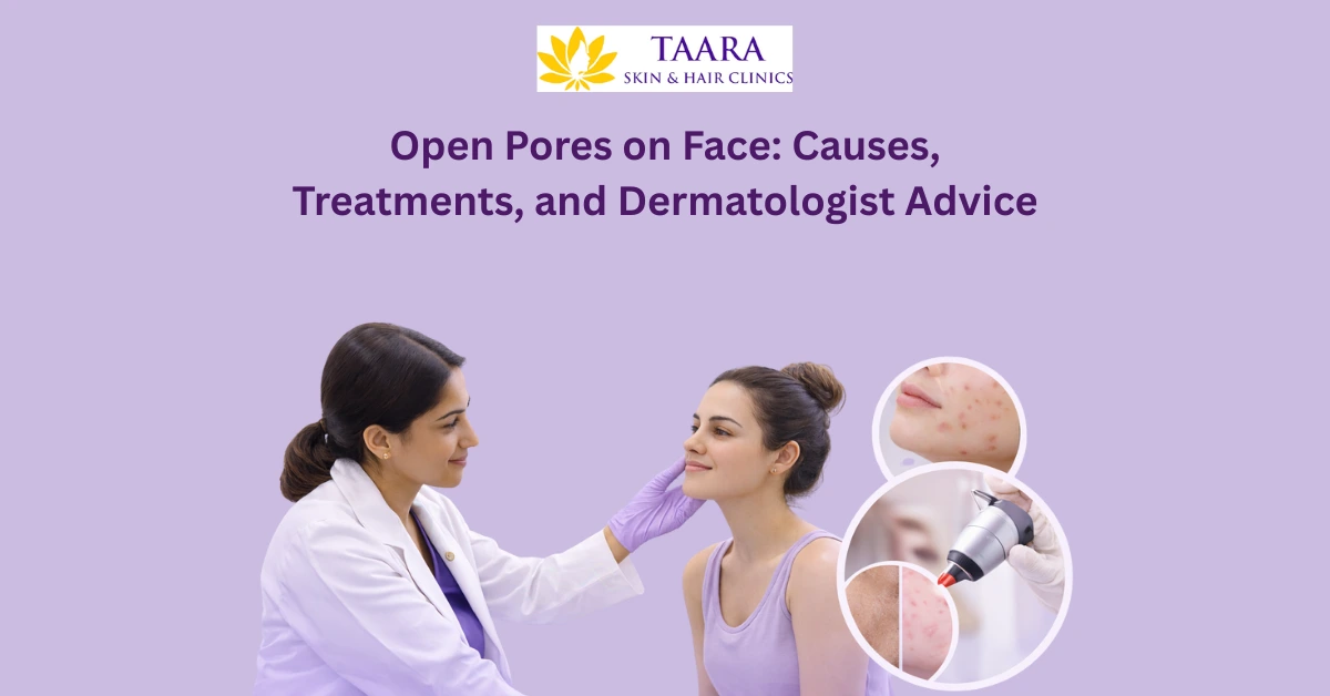 Open pores on face